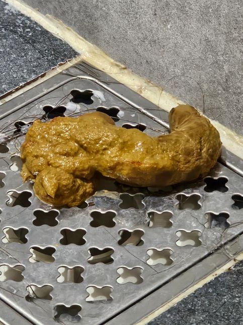 고양이가 똥 쌌는데 피가 묻어있습니다.의 1번 째 이미지