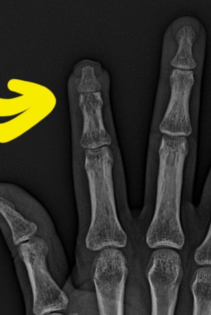 산재종결 후 외상성관절통이 생겼는데 추가상병으로 신청이 가능할까요?의 1번 째 이미지