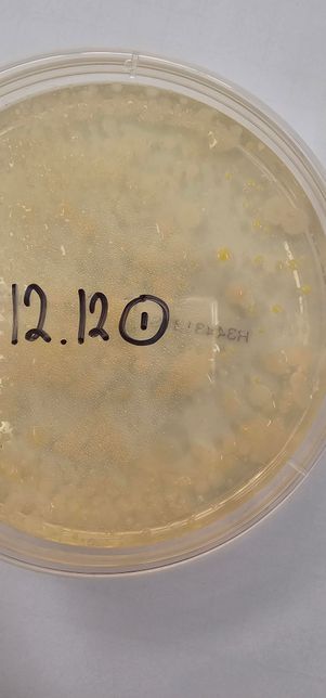 배지에 플라스틱 용액을 얇게 깔고 흙 속 미생물도 깔고 난 3일 후 하얀색 점과 노란색 점이 올라왔는데 실험 해석해주실 분 있으신가요?의 1번 째 이미지