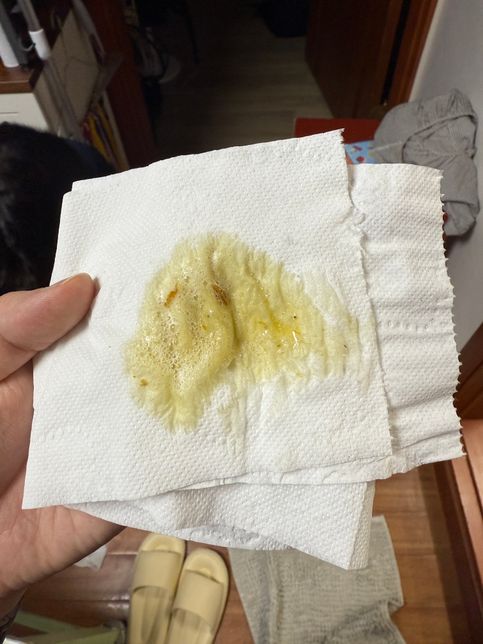 강아지가 전날 밤 노란거품토 한 이후 아침에는 간식을 토했어요의 0번 째 이미지