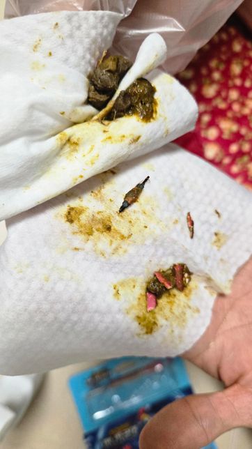 사진 주의 강아지배변 죄송합니다..강아지가 이물질 스마트폰 터치팬을 씹어삼켰어요의 1번 째 이미지