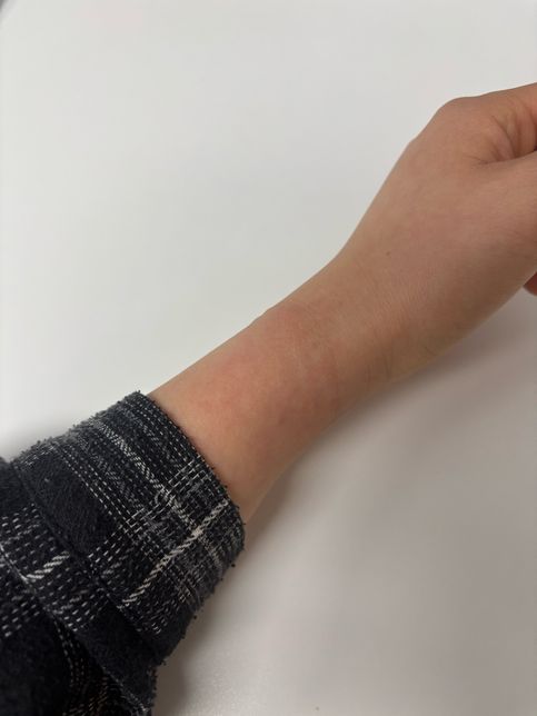 마취 주사 (혈관 터짐, 알러지반응) 의료 보상의 3번 째 이미지