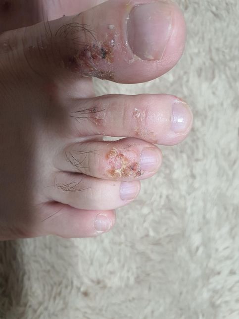 1년이 넘도록 이어진 간지러움 및 피부발진의 3번 째 이미지