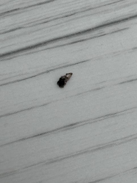 이 작은 벌레 진드기인가요..? ㄷㄷ의 0번 째 이미지