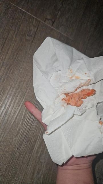 이게뭔가요?혈토인가요아니면 혈변인가요 ㅡ 알려주세요의 0번 째 이미지