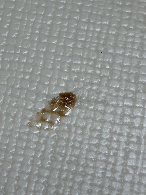 강아지 점액질변 같은 게 묻었는데 병원 가야하나요?의 0번 째 이미지