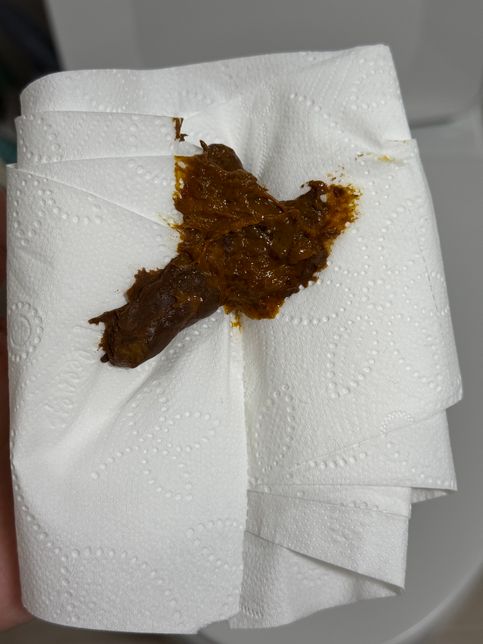 강아지 변이 묽고 오늘 토했는데 괜찮을까요?*똥 사진 있음의 0번 째 이미지