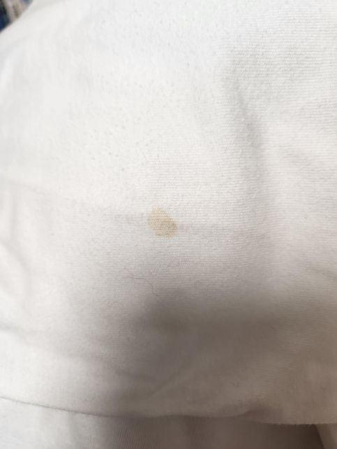 흰옷 세탁해도 안지워지는 얼룩 목라인 인체얼룩 제거방법의 1번 째 이미지