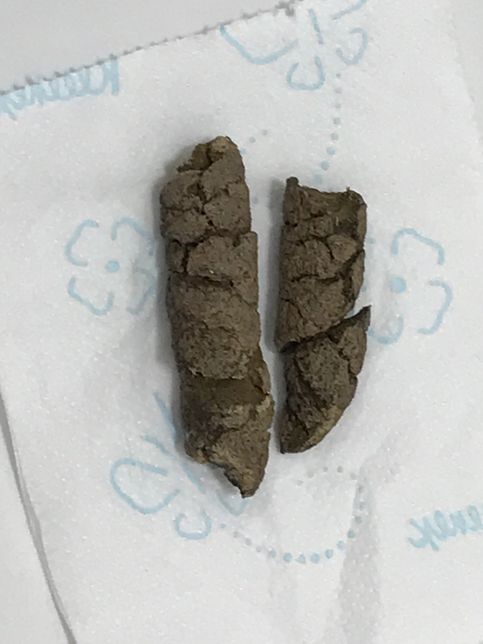 강아지가 변을 2-3일째 계속 이상하게 누는데 항상 이렇게 누는건 아니고 하루 5번 중에 1번은 꼭 이렇게 싼지 2-3일째이고 갈수록 점점 심해지는데 이유를 모르겠습니다의 3번 째 이미지