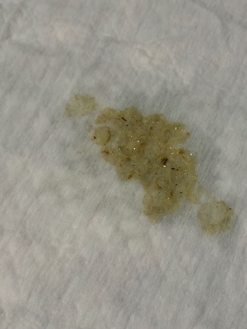 강아지 장폐색 인가요? 토사진있어요의 1번 째 이미지