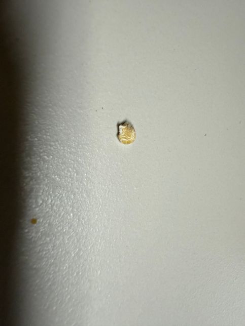 포리지오트밀에 솜털이 껍질 혹은 곰팡이인지의 2번 째 이미지