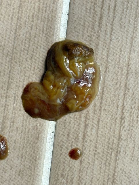 강아지 변 형태가 특이합니다. (사진주의)의 0번 째 이미지