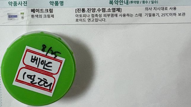 처방받은 약, 연고 같이 복용 및 사용해도 되나요?의 2번 째 이미지