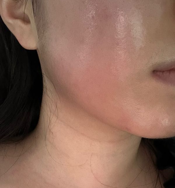 비대면 진료로 약 처방 받았는데 이 약 먹어도 될까요?의 0번 째 이미지