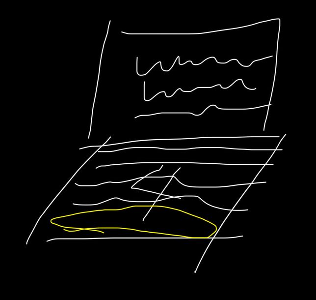 통장을 atm기에 넣었는데 예상 밖에의 0번 째 이미지