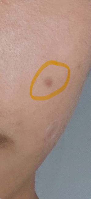 피부가 안좋아졌는데 어떻게해야할지모르겠어요(사진있음)의 1번 째 이미지