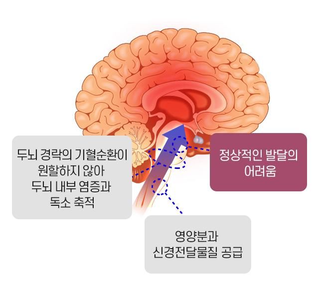 죽은 발달장애인의 몸 속에 두개골을 해부하면 뇌유전자 연구에 도움이 될까요?의 0번 째 이미지