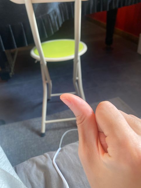 이거 고치는 방법 없을까요......의 0번 째 이미지