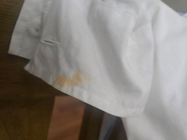 흰셔츠에 양념국물 묻었을때 제거방법의 0번 째 이미지