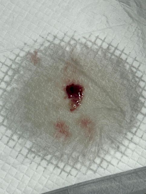 결석 강아지 결석 사료 먹고있는데 갑자기의 1번 째 이미지