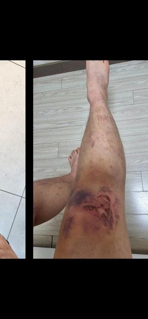 12월 19일 발산역 횡단보도 사고입니다ㅠㅠ의 0번 째 이미지