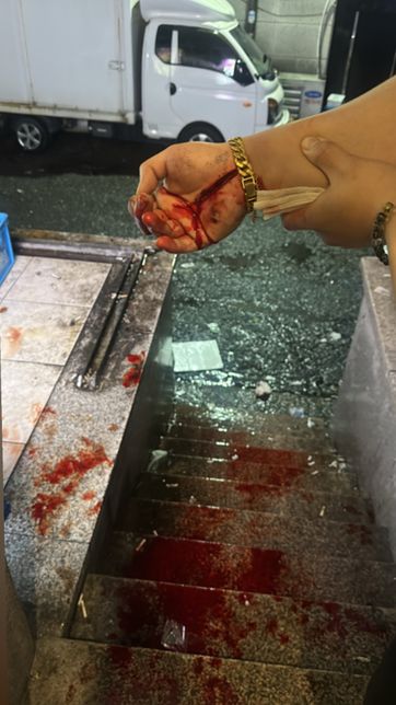 계단미끄러짐 사진 징그러움주의 드립니다의 1번 째 이미지