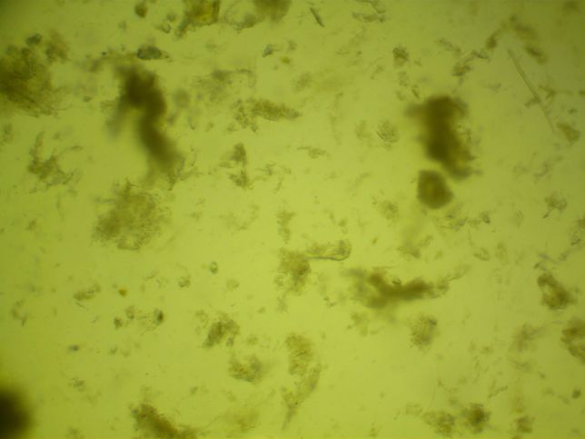 강아지 분변검사에서 간균 이 많다는데.. 이런 경우 치료를 다른 병원들은 어떻게 하나요?의 0번 째 이미지