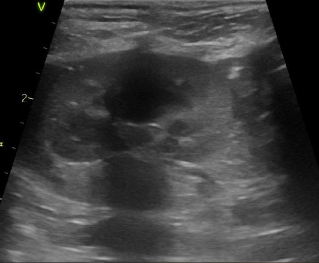 강아지 신장결석 칼슘옥살 스트루바이트 둘중 어느것 같아보이는지요?의 0번 째 이미지