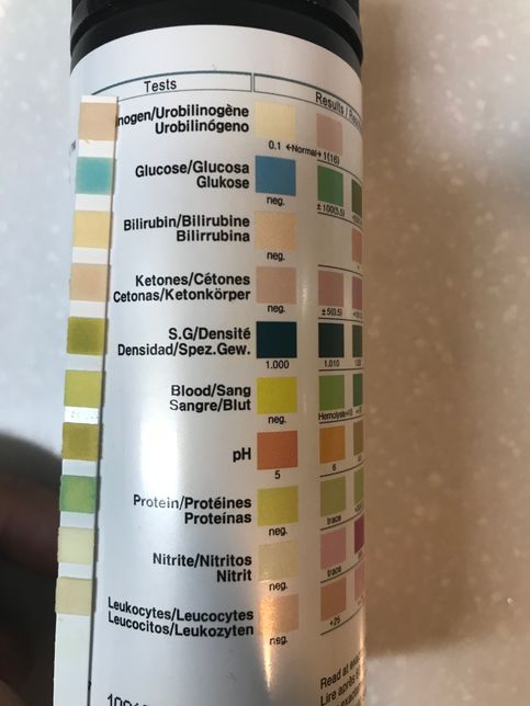 소변 검사 키트들은 원래 다 이런건가요?의 2번 째 이미지