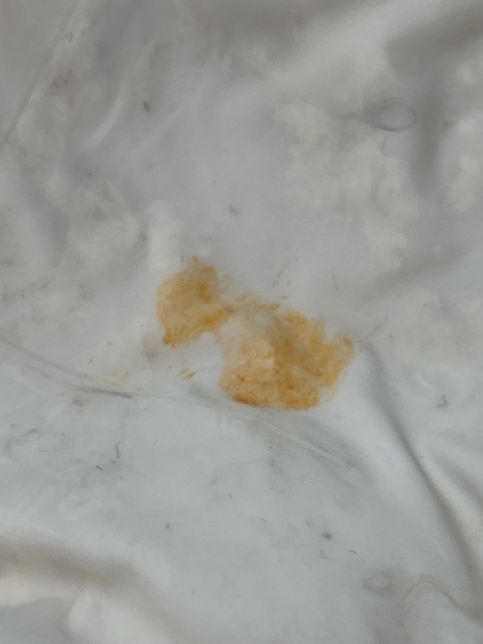 패딩에 묻은 빨간 기름 지우는 방법 알려주세요ㅠ의 0번 째 이미지