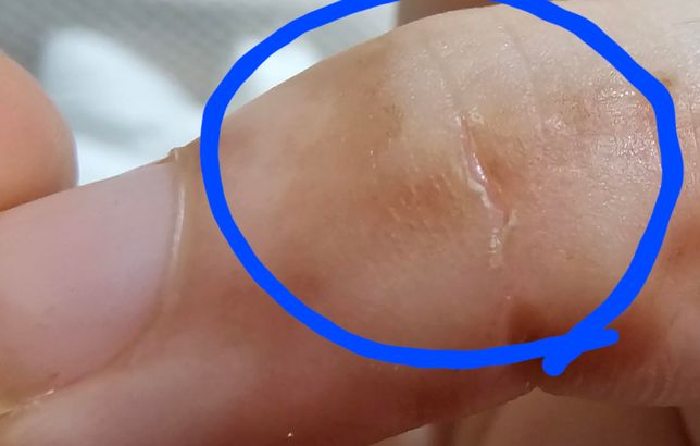 포비돈 상처에 직접 바르면 안되나요?의 0번 째 이미지