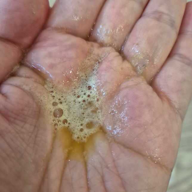 11주 된 강아지 노란 구토 왜하는거죠?의 0번 째 이미지