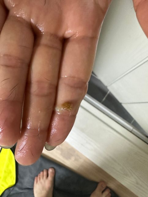 강아지 항문낭 짜면 이렇게 나오는게 정상인가요?의 0번 째 이미지