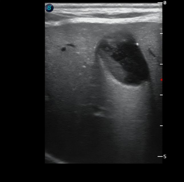 강아지 간수치 상승 원인이 대체 뭘까요 ㅜㅜ의 0번 째 이미지