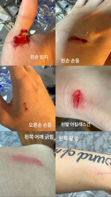 폭행 사건 합의금은 얼마까지가 적당할까요..?의 0번 째 이미지