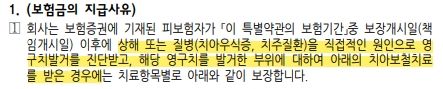 DB 참좋은 치아사랑 보험 1801, 라이나 생명 치아보험의 1번 째 이미지