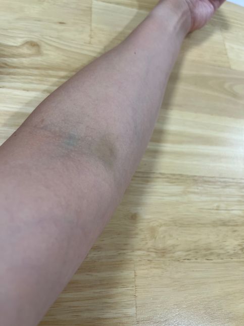 단순폭행신고 쌍방인가요?????의 0번 째 이미지