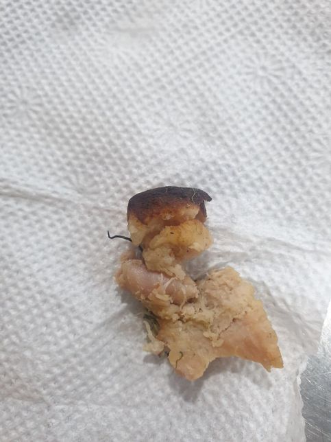 음식점 음식 내 이물질 관련 손해배상 청구 등에 대해 질문 드립니다의 0번 째 이미지