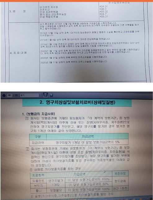 어머니 치아보험 보상방안 문의드립니다?의 0번 째 이미지