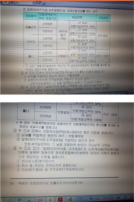 어머니 치아보험 보상방안 문의드립니다?의 1번 째 이미지