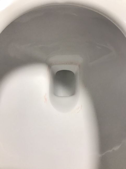 화장실 세면대, 변기 붉게 변하는건 왜 그런건가요?의 0번 째 이미지