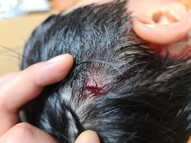 아파트내 시설물 이용중 다쳤는데 보상 받을 수 있나요?의 1번 째 이미지