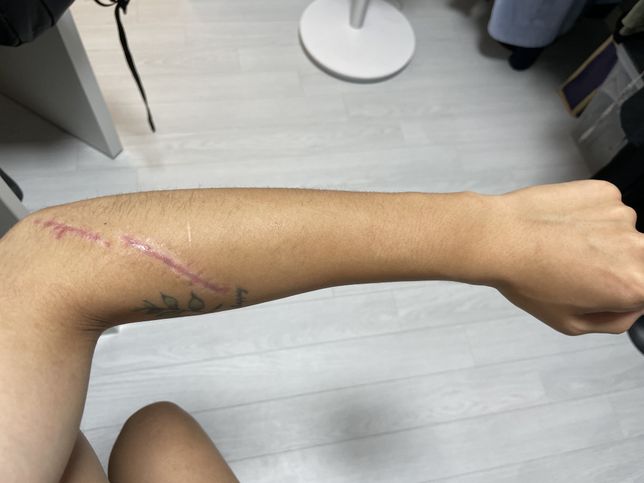 업무 중 다쳤습니다. 산재를 받고 싶은데 고민이 너무 많습니다. 제가 너무 바보인가요?의 1번 째 이미지