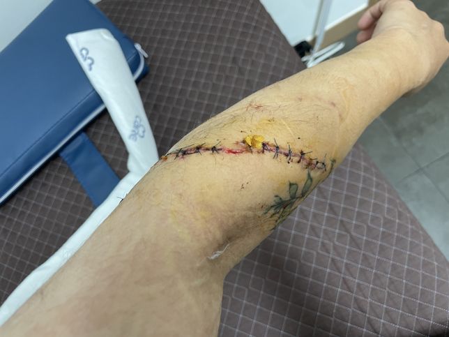 업무 중 다쳤습니다. 산재를 받고 싶은데 고민이 너무 많습니다. 제가 너무 바보인가요?의 0번 째 이미지