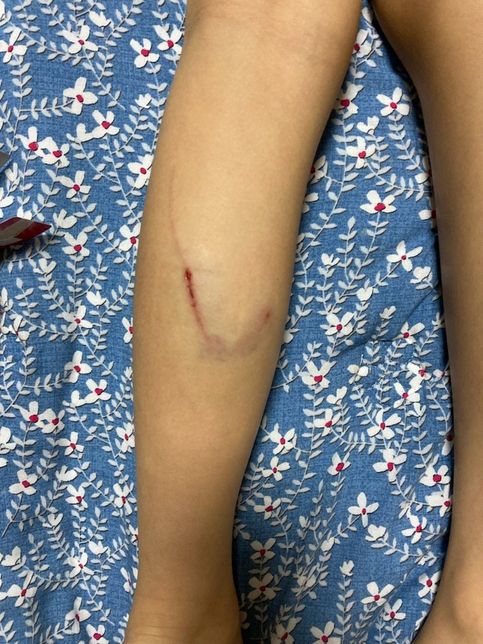 강아가 물었을때 피해보상금액의 0번 째 이미지