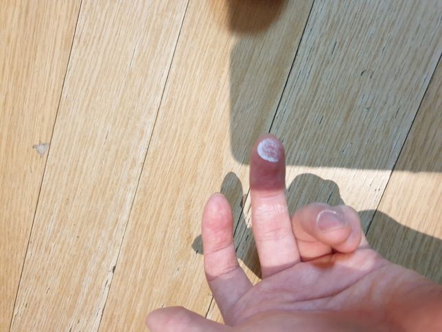 (사진o)영양제 안에 하얀색 가루들 있는데 먹어도 될까요???의 0번 째 이미지