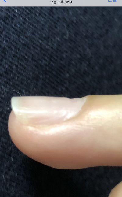 네일샵 업무상과실치사,고객보호의무위반 고소 가능할까요?의 0번 째 이미지