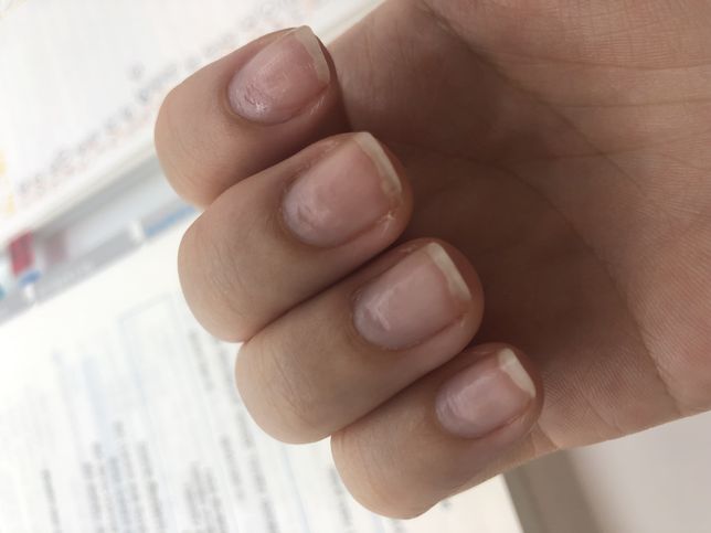 네일샵 업무상과실치사,고객보호의무위반 고소 가능할까요?의 1번 째 이미지