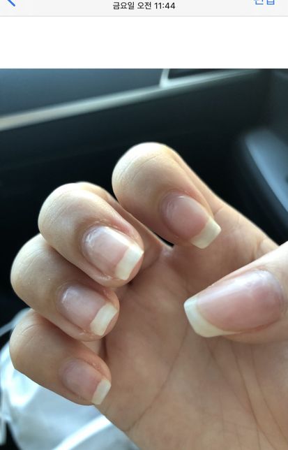 네일샵 업무상과실치사,고객보호의무위반 고소 가능할까요?의 2번 째 이미지