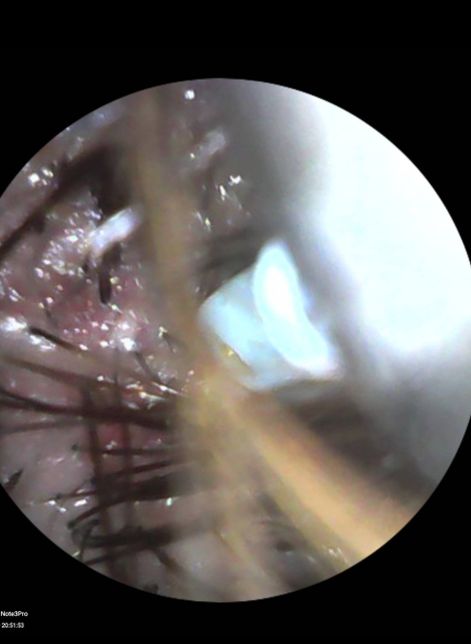 미용실 염색 후 염증 발생에 대한 처리여부의 2번 째 이미지